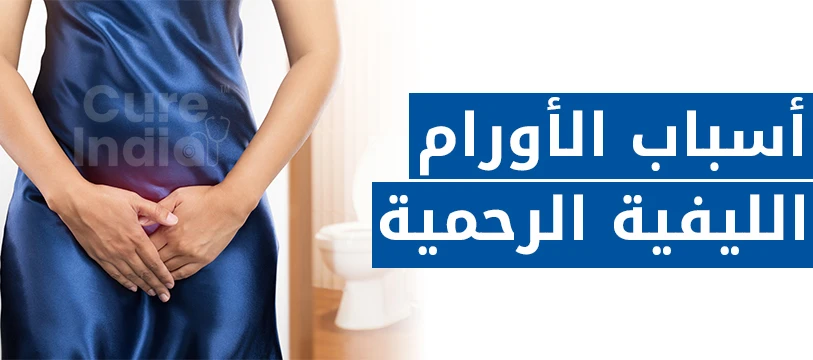 أسباب الأورام الليفية الرحمية